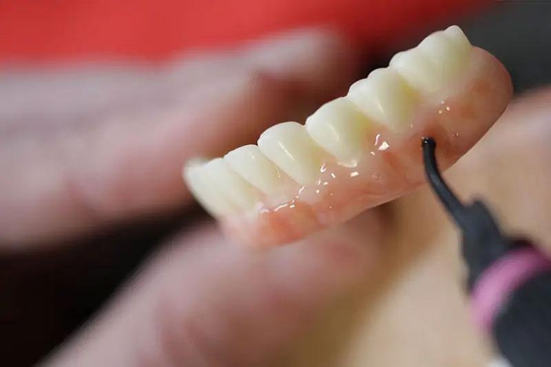 The Stabili-Teeth™ Treatment Process