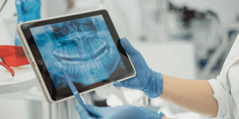 Why Cbct Scans Are Critical For Accurate Dental Implant Placement: A Modern Guide