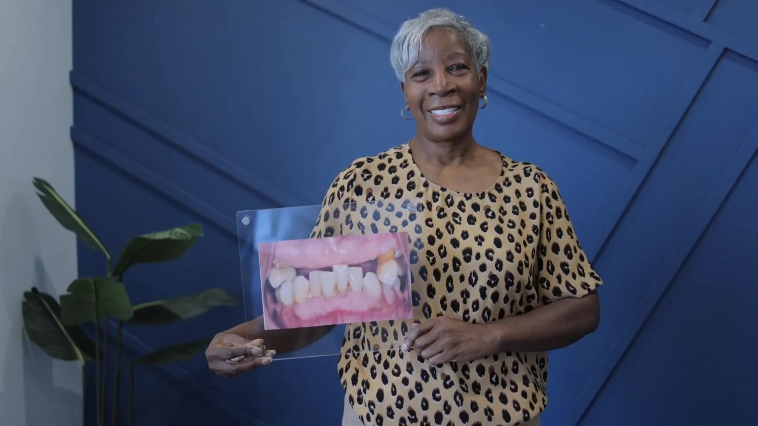 Dental Implant Aftercare Guide