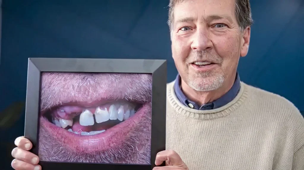 Ready To Reclaim Your Confident Smile 1024X572 1