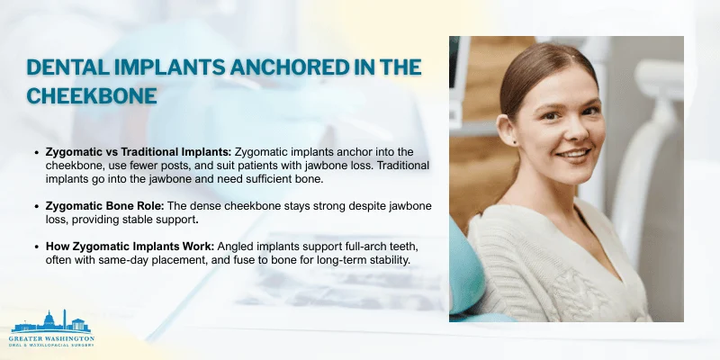 Understanding Zygomatic Dental Implants: When They’re Recommended And Why 2 What Are Zygomatic Dental Implants