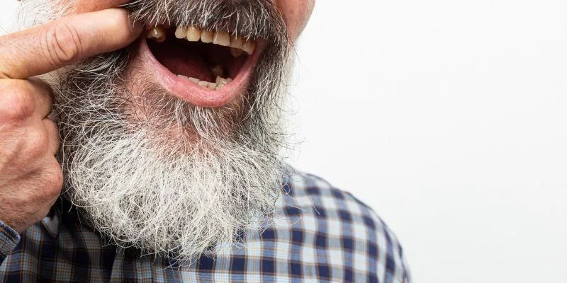 Why Single Missing Teeth Can Cause Bigger Problems Than You Think: The Hidden Risks And Effective Solutions