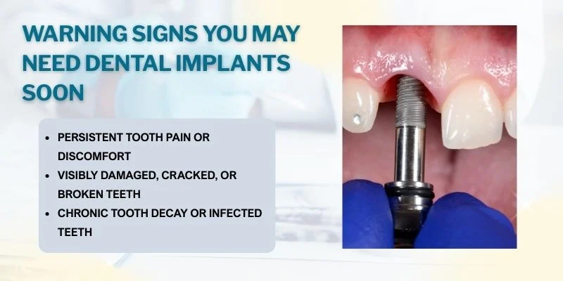 Warning Signs You May Need Dental Implants Soon
