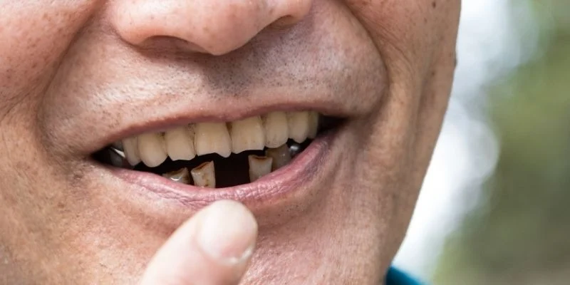Changes In Oral Function And Appearance