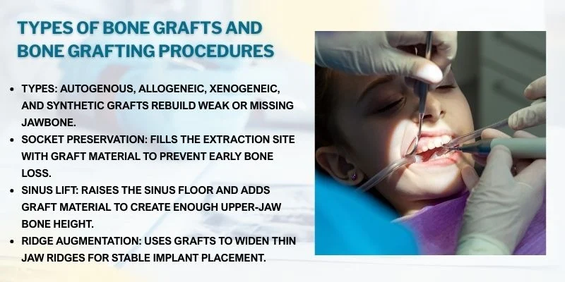 When Jaw Bone Grafting Becomes Necessary Before Dental Implants: What Patients Need To Know 3 Types Of Bone Grafts And Bone Grafting Procedures