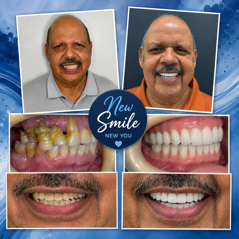 Dental Patient Before &Amp; After 001