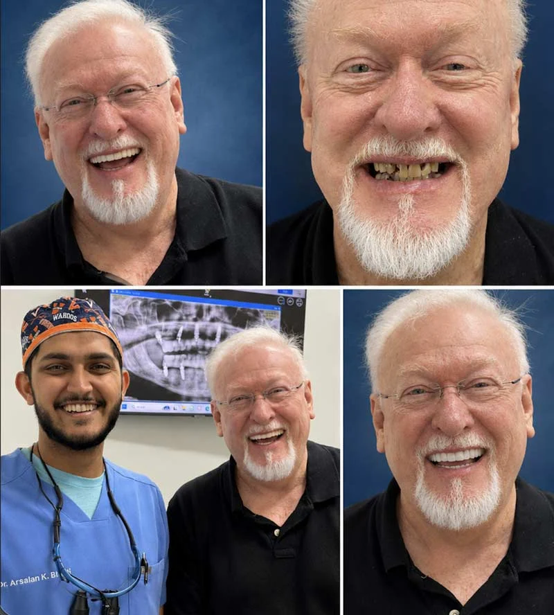 Dental Patient Before &Amp; After 002