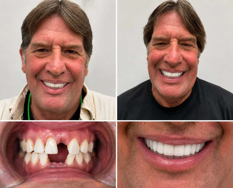Dental Patient Before &Amp; After 003
