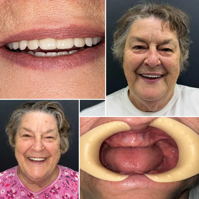 Dental Patient Before &Amp; After 005