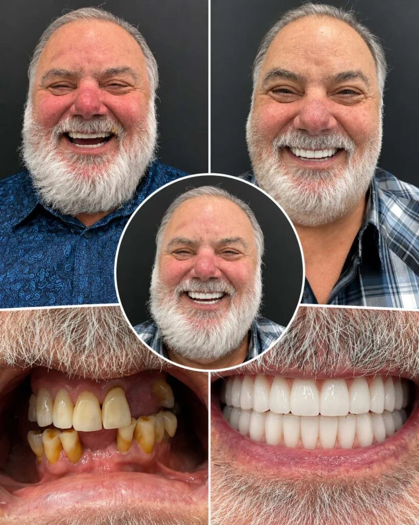 Dental Patient Before &Amp; After 006