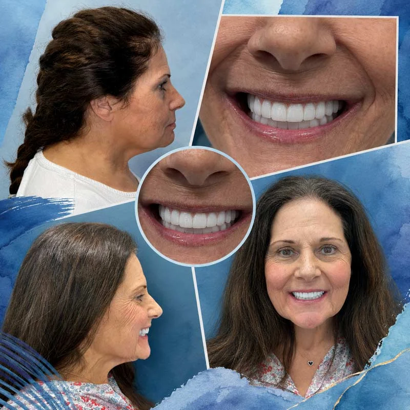 Dental Patient Before &Amp; After 009