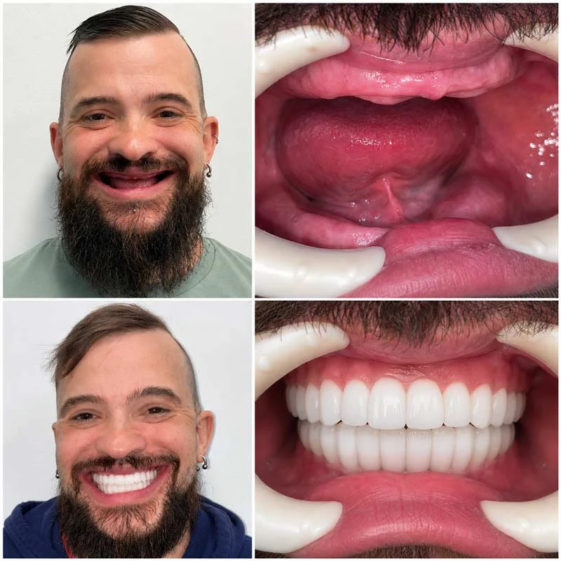Dental Patient Before &Amp; After 010