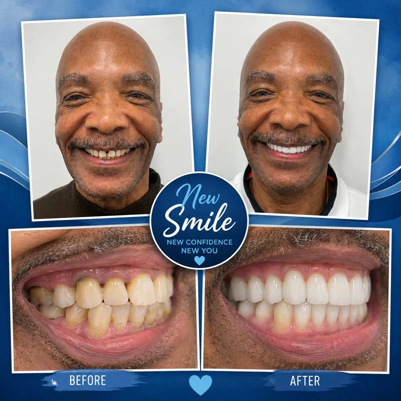 Dental Patient Before &Amp; After 011