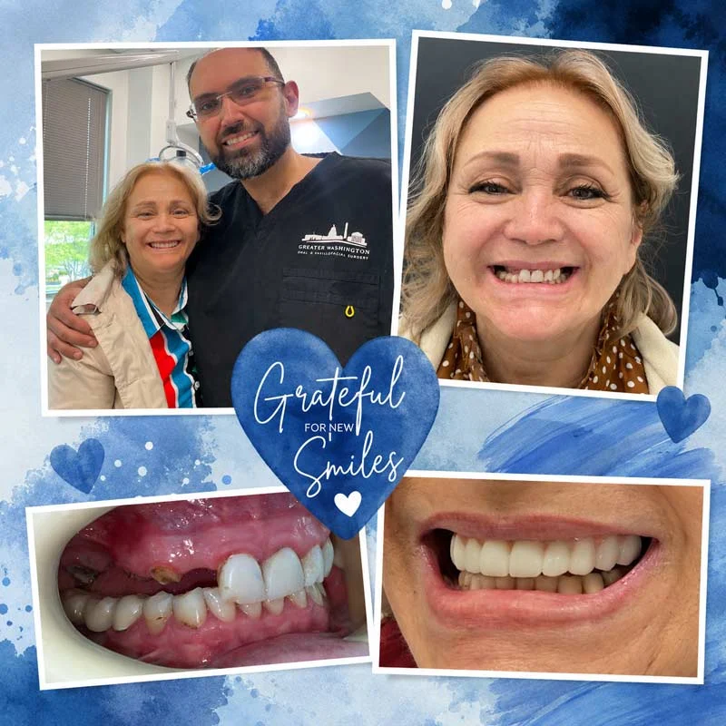 Dental Patient Before &Amp; After 012