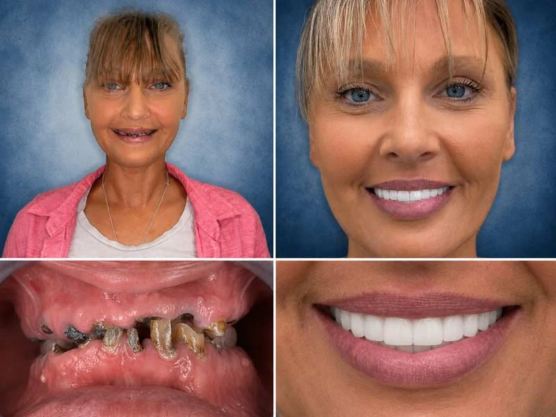 Dental Patient Before &Amp; After 013