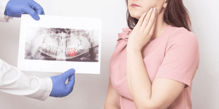 The Hidden Costs of Delaying Wisdom Tooth Removal: Uncovering Essential Risks and Realities