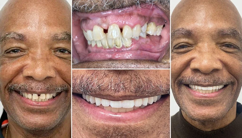 Smile Gallery 02 1024X586 1